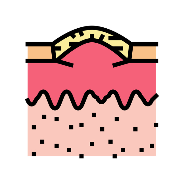 boxcar acne scar color icon vector. boxcar acne scar sign. isolated symbol illustration