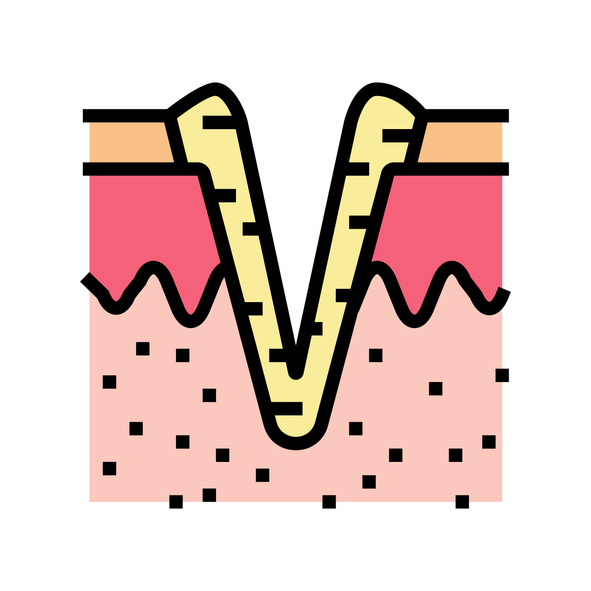 ice pick acne scar color icon vector. ice pick acne scar sign. isolated symbol illustration