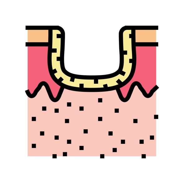 hypertrophic acne scar color icon vector. hypertrophic acne scar sign. isolated symbol illustration